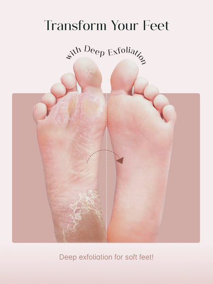 SeoulSkin™ SmoothPeel Foot Mask | BOGO Offer